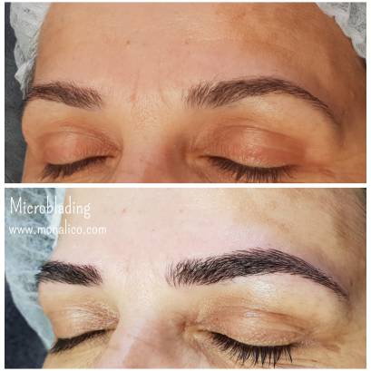 Cejas tatuadas antes y despues en centro especializado
