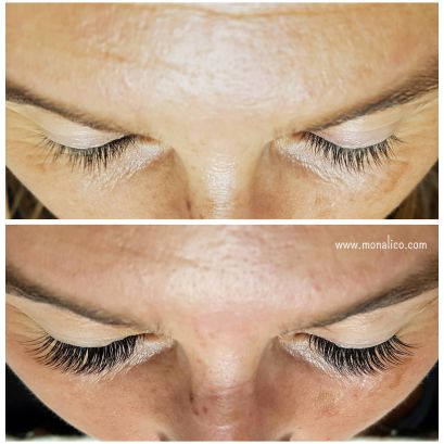 Extensiones rusas en Monalico