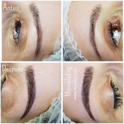 Tratamiento para cejas en Monalico