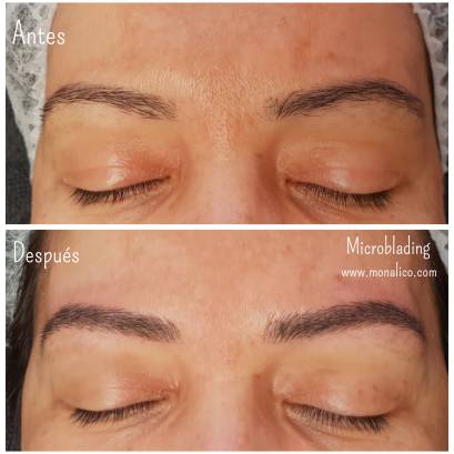 Micropigmentación de cejas recuperacion en centro especializado