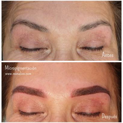 Microblading cost en centro especializado