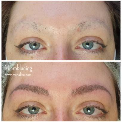 Clinica para tatuar cejas en Monalico