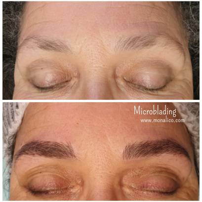 Relleno de cejas permanente en centro especializado