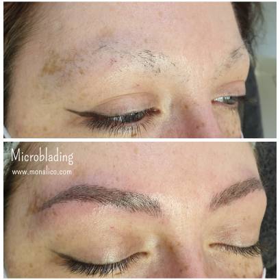 Cejas antes y despues en Monalico