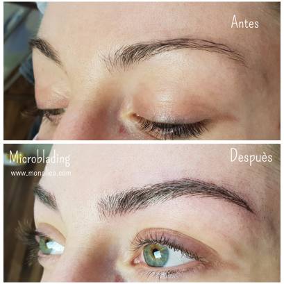 Microblading alopecia en Monalico