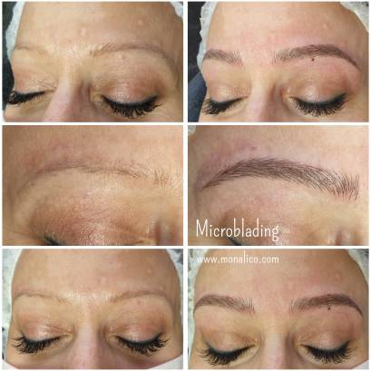 Microblading before and after en centro especializado