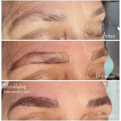 Microblading cost