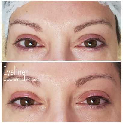 Micropigmentación en los ojos