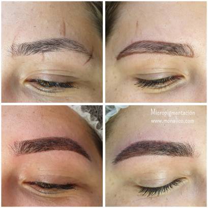 Microblading healing