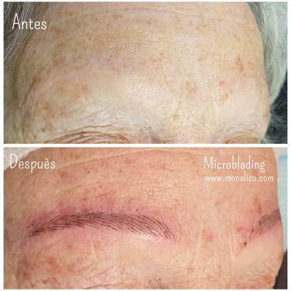 What is microblading