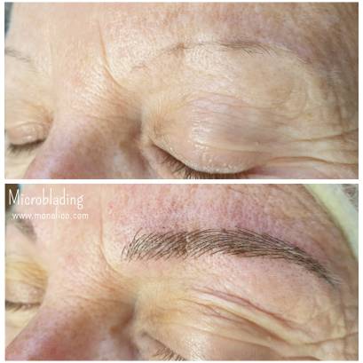 Tratamiento para cejas despobladas