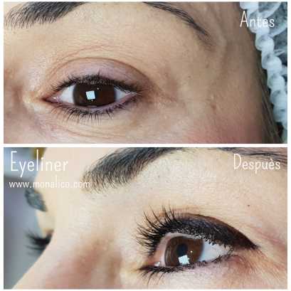 Pigmentación de ojos