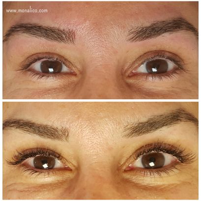 Pegamento medico para extensiones de pestañas